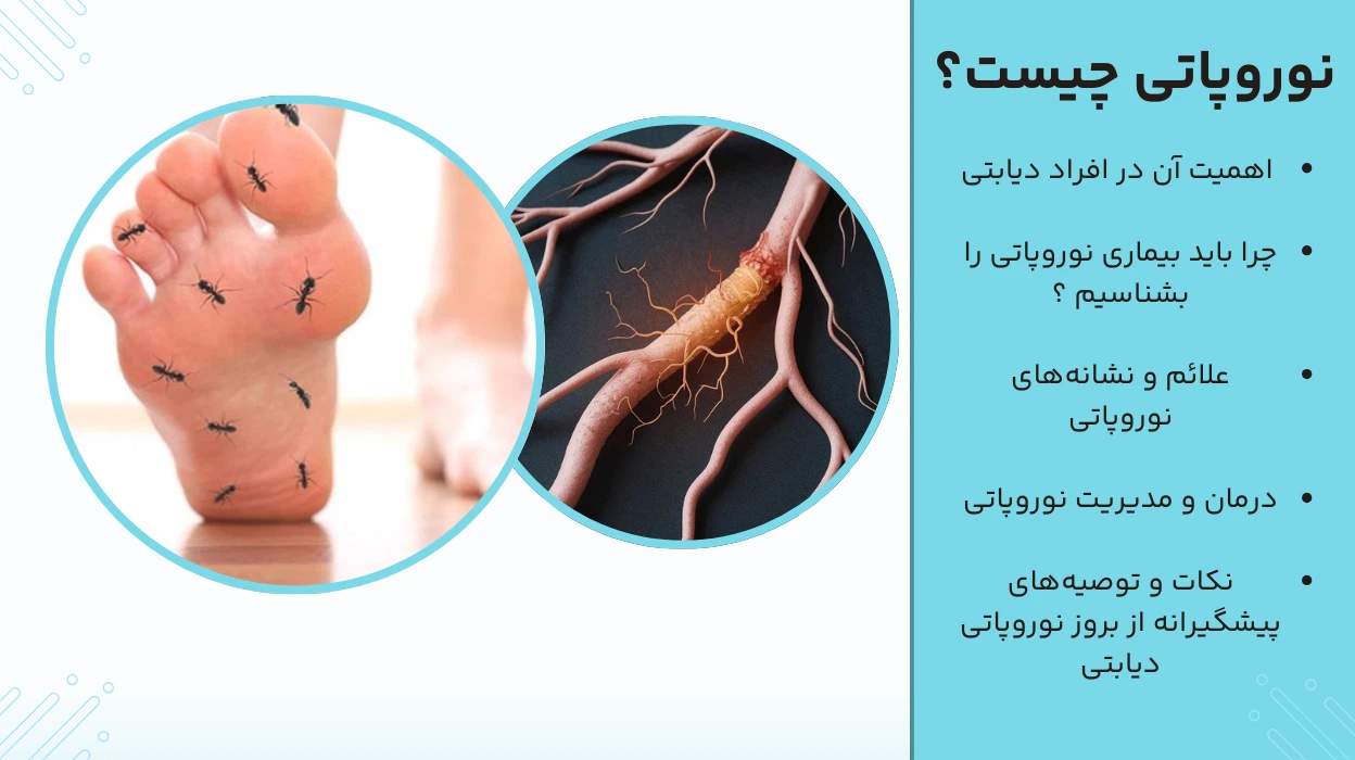نوروپاتی چیست ؟ و اهمیت آن در افراد دیابتی