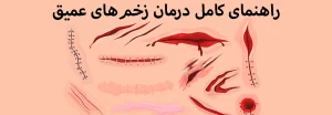 مجله سافیرامد 7 راهنمای جامع درمان زخم عمیق